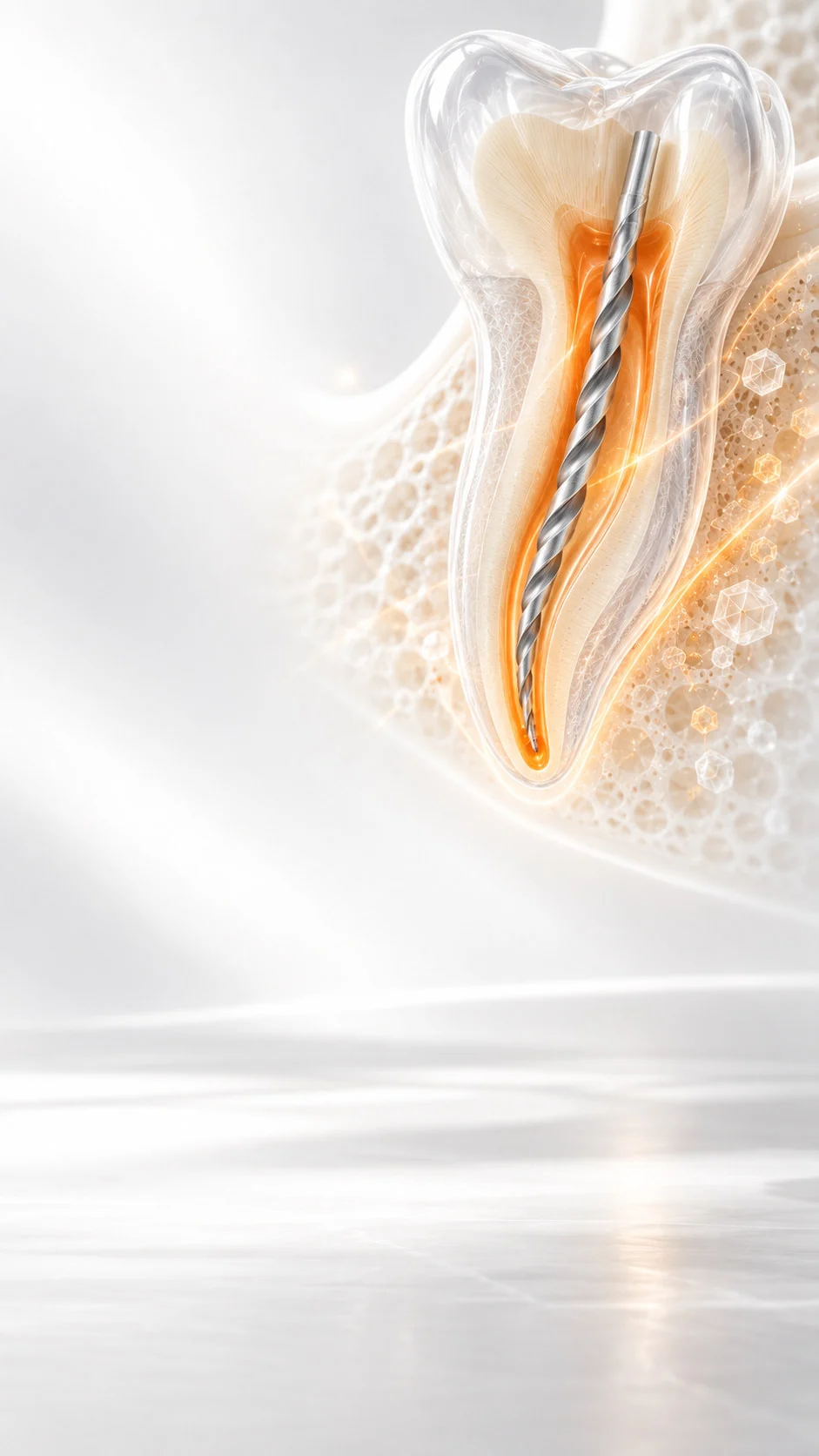 Conceptual illustration for Rotary Files - 06 Taper