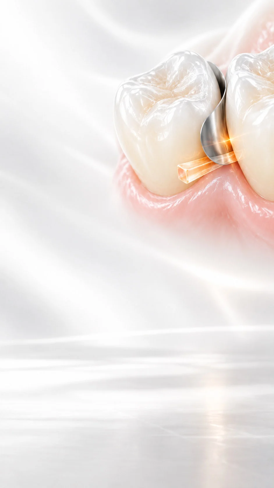 Conceptual illustration for Transparent Wedges